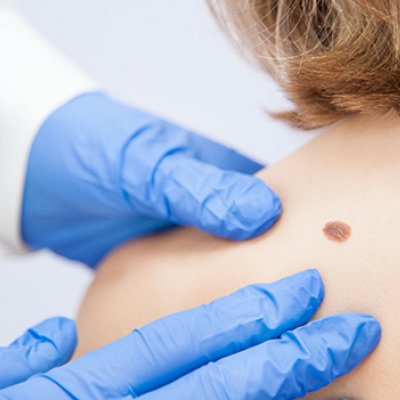 Stock image of a doctor examining a patient's skin 